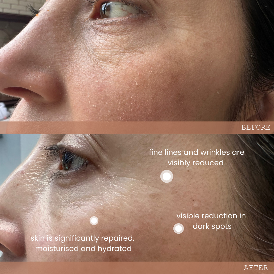 ECLIPSE DUO | A DAY & NIGHT TREATMENT
