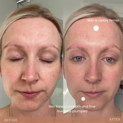 REBIRTH ANTI AGEING SERUM WITH MARINE COLLAGEN