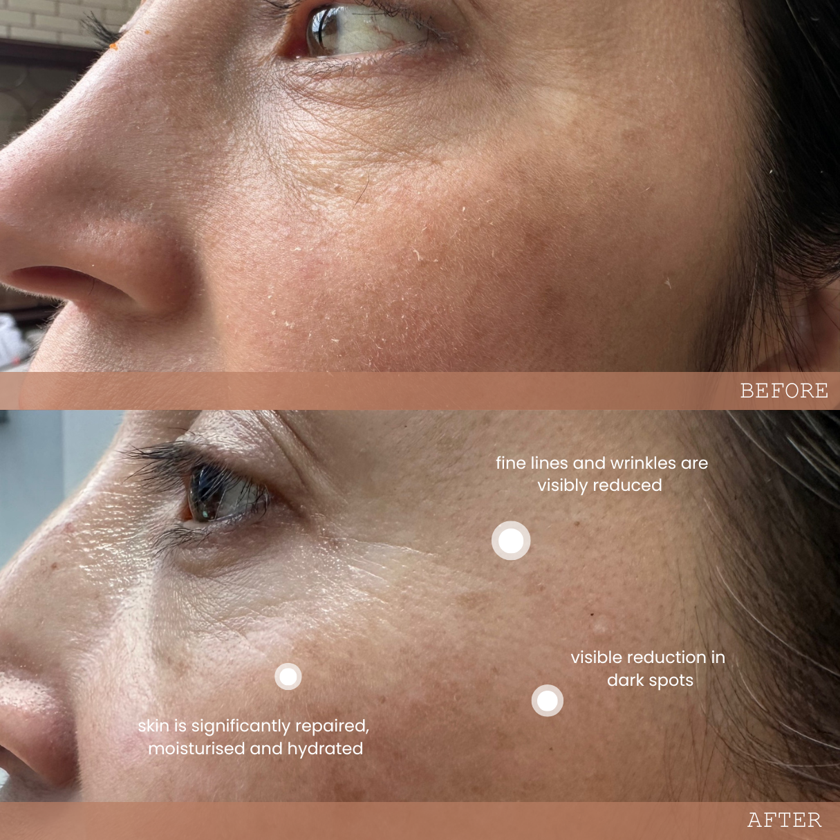 Biomama Skincare Before and after image (43 year old mother)